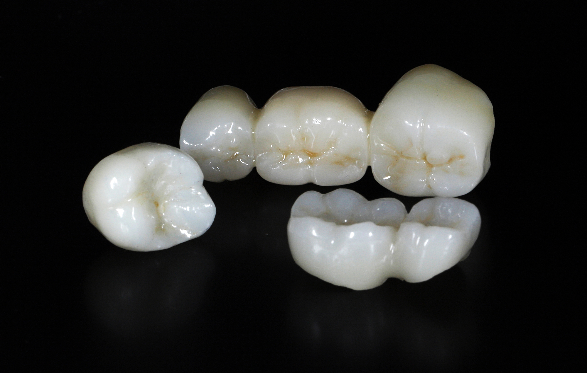 Kvalitetne zobne krone so dolgoročna rešitev